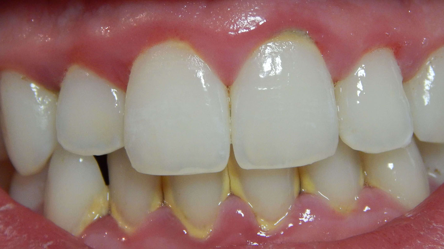 Periodontologia